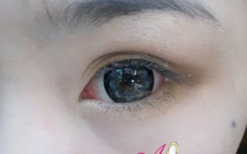 ��������������y��