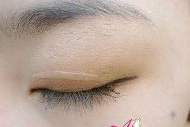 ��������������y��