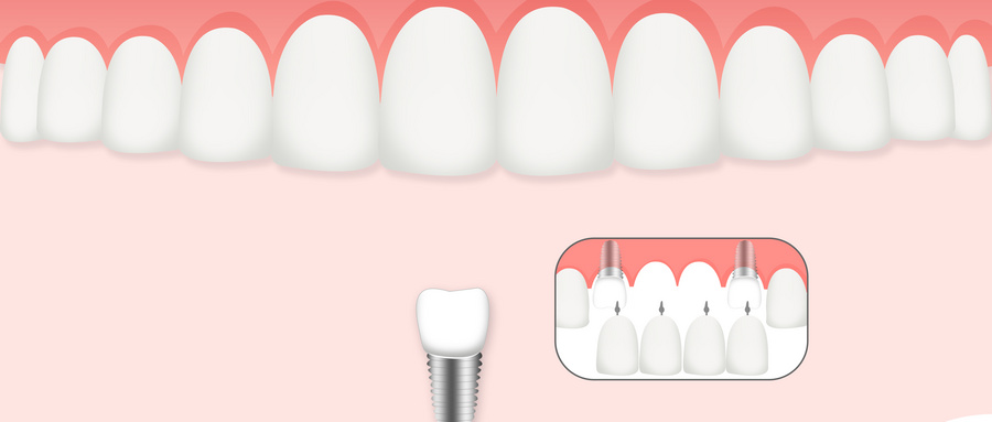 �����ǿƼ����WУ���V���׃���ǻ����o����